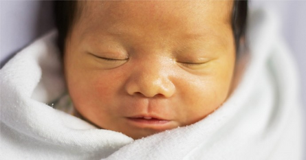 newborn with jaundice